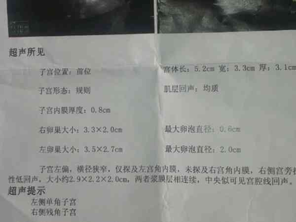 长沙生殖医学医院试管技术盘点，残角子宫能不能生育30s说清