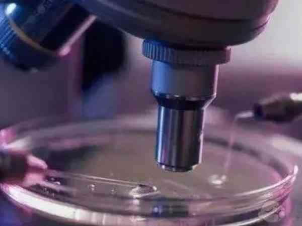 不造人工受孕可不可以自己选精子？看看医生是怎么说的