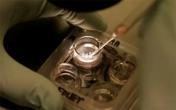 激素变化是移植后流黄色液体原因之一